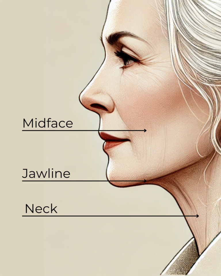 Facial Vaser Liposuction Areas