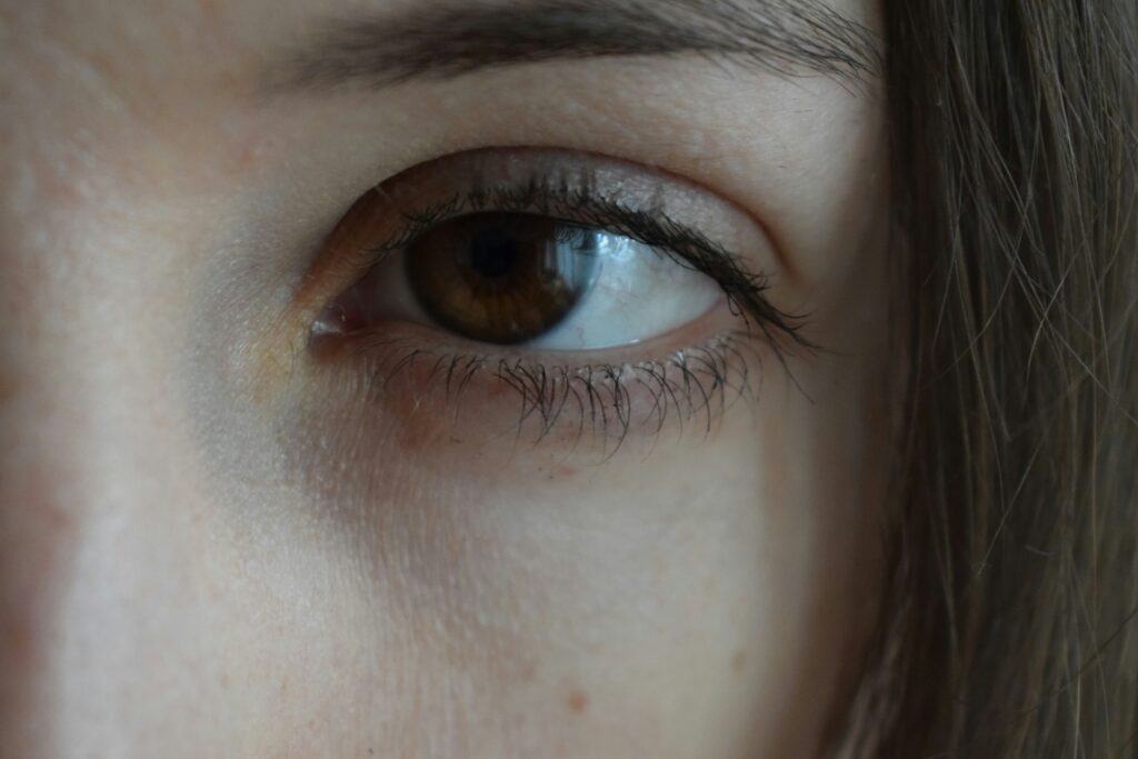 face photo centered around the eye to highlight eye concerns