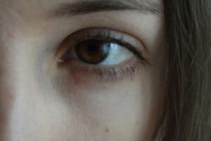 face photo centered around the eye to highlight eye concerns