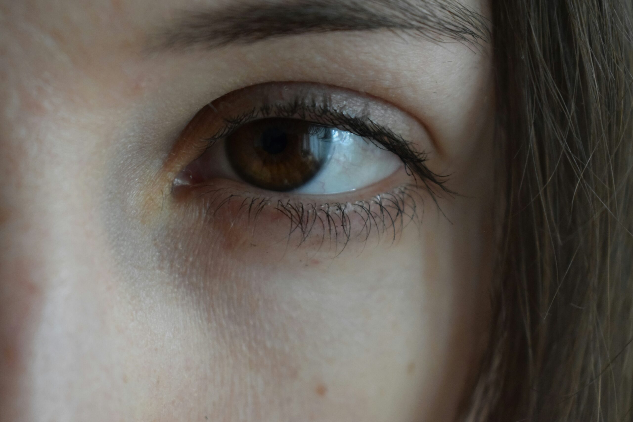 face photo centered around the eye to highlight eye concerns